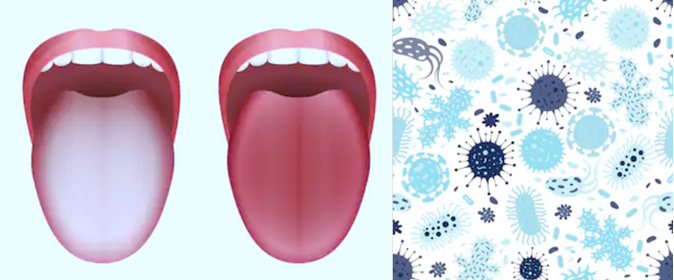 舌細菌